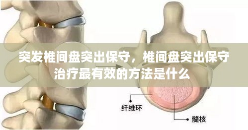 突發(fā)椎間盤突出保守，椎間盤突出保守治療最有效的方法是什么 