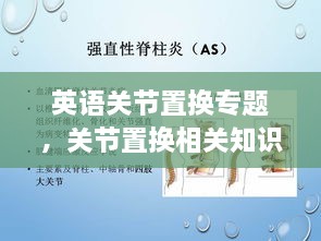 英語(yǔ)關(guān)節(jié)置換專(zhuān)題，關(guān)節(jié)置換相關(guān)知識(shí) 