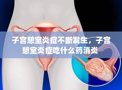 子宮憩室炎癥不斷發(fā)生，子宮憩室炎癥吃什么藥消炎 
